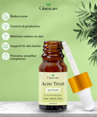 Acne Treat Serum - Reduce pimples & Controls oil