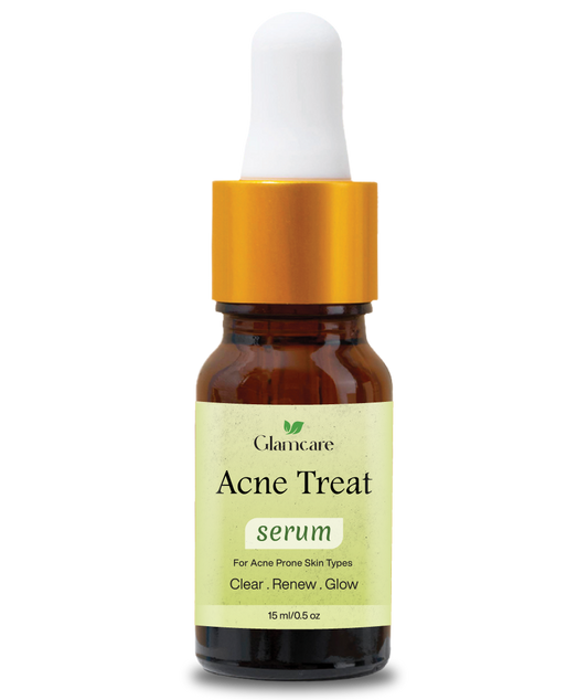 Acne Treat Serum - Reduce pimples & Controls oil